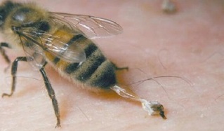 Tratamento da artrose de cadeira por abellas