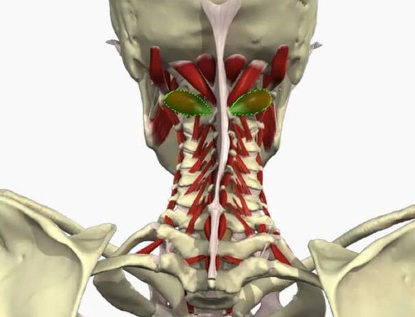 Síndrome da arteria vertebral